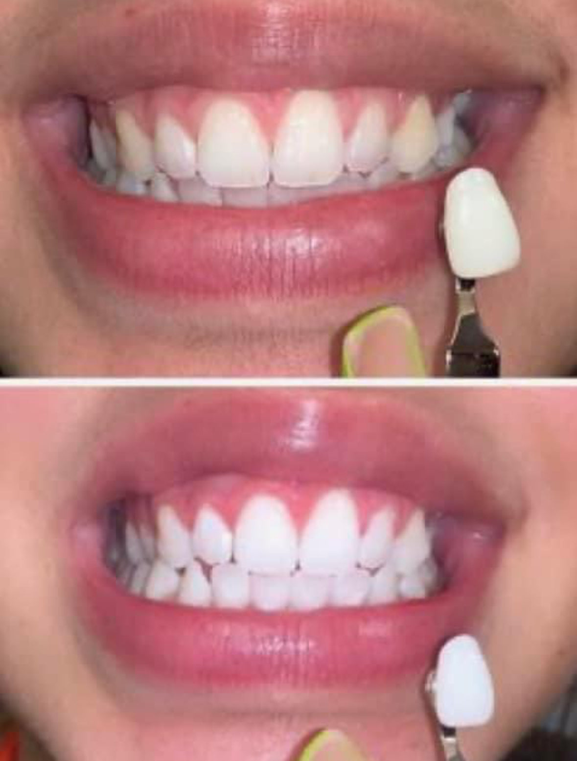 STARLET TEETH WHITENING PEN