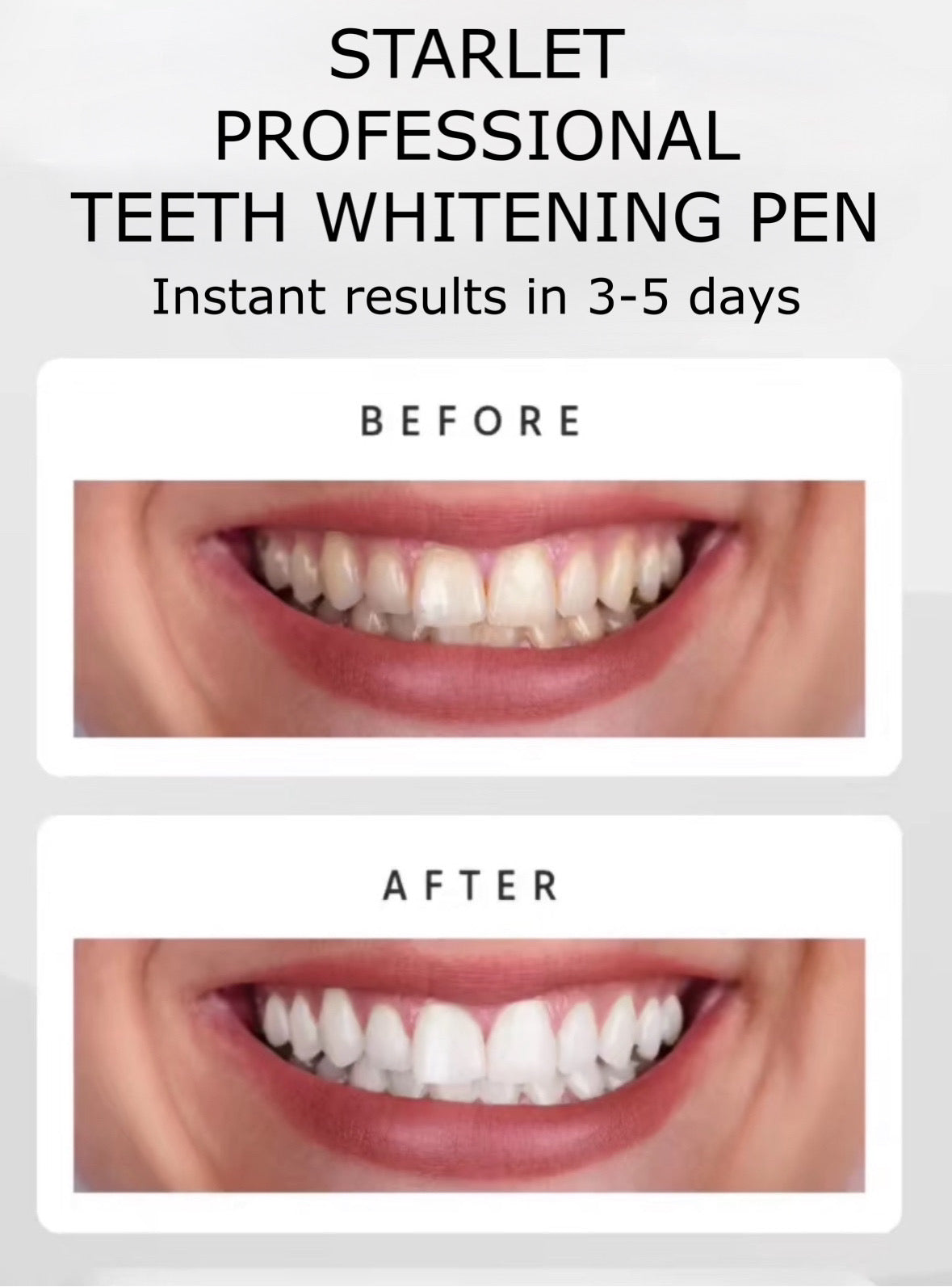 STARLET TEETH WHITENING PEN
