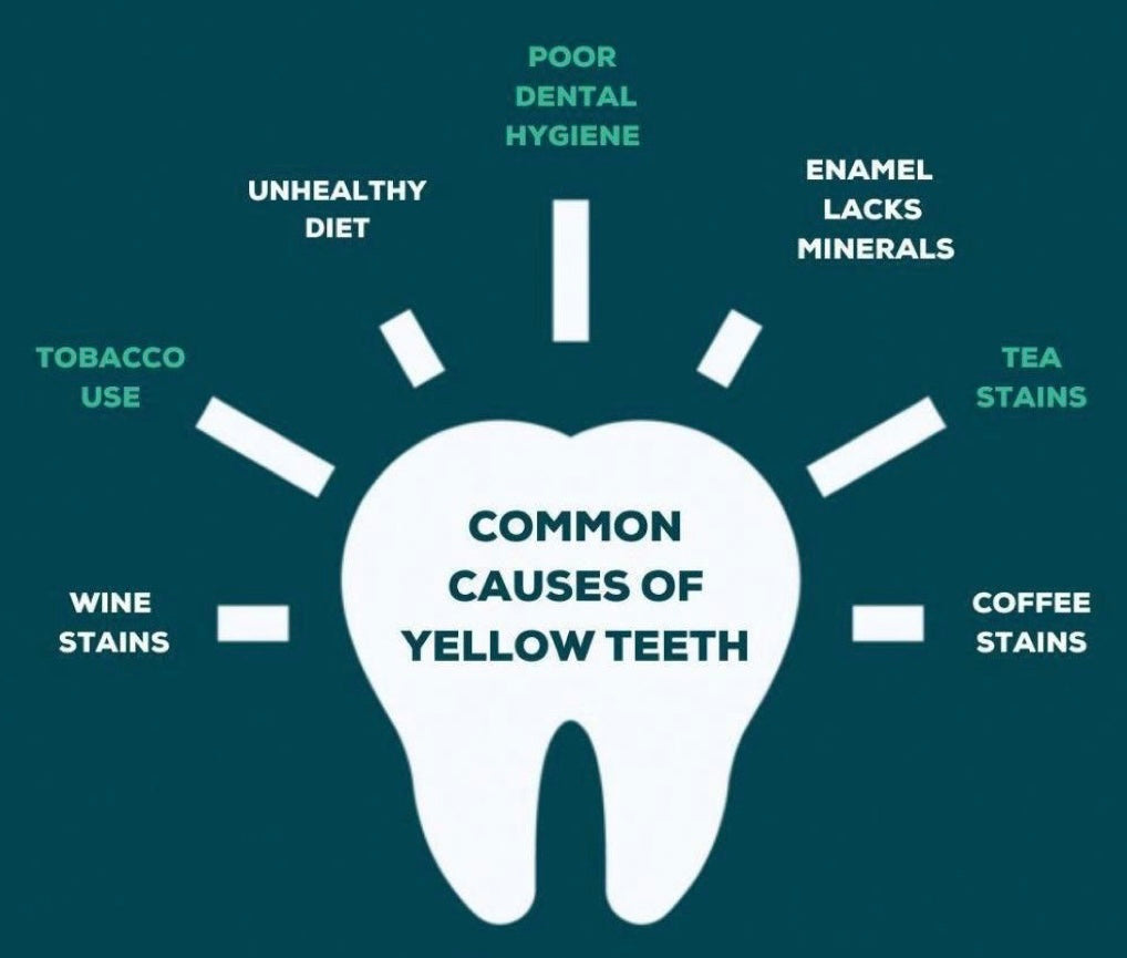 STARLET TEETH WHITENING PEN